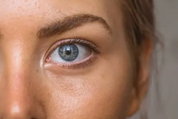 What\'s your clear skin IQ?